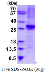 CD1B Protein