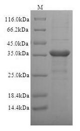 CD1C Protein - (Tris-Glycine gel) Discontinuous SDS-PAGE (reduced) with 5% enrichment gel and 15% separation gel.