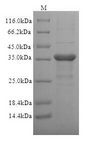 CD1C Protein - (Tris-Glycine gel) Discontinuous SDS-PAGE (reduced) with 5% enrichment gel and 15% separation gel.