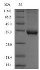 CD1C Protein - (Tris-Glycine gel) Discontinuous SDS-PAGE (reduced) with 5% enrichment gel and 15% separation gel.