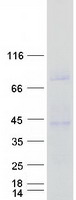 CD1C Protein - Purified recombinant protein CD1C was analyzed by SDS-PAGE gel and Coomassie Blue Staining