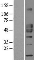 CD1D Protein - Western validation with an anti-DDK antibody * L: Control HEK293 lysate R: Over-expression lysate