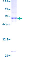 CD1D Protein - 12.5% SDS-PAGE of human CD1D stained with Coomassie Blue