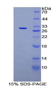 CD1D Protein - Recombinant Cluster Of Differentiation 1d By SDS-PAGE