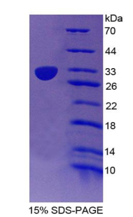 CD1E Protein - Recombinant Cluster Of Differentiation 1e By SDS-PAGE