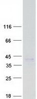 CD1E Protein - Purified recombinant protein CD1E was analyzed by SDS-PAGE gel and Coomassie Blue Staining