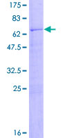 CD2 Protein - 12.5% SDS-PAGE of human CD2 stained with Coomassie Blue