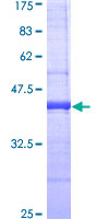 CD2 Protein - 12.5% SDS-PAGE Stained with Coomassie Blue.