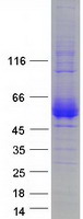 CD2 Protein - Purified recombinant protein CD2 was analyzed by SDS-PAGE gel and Coomassie Blue Staining