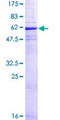 CD20 Protein - 12.5% SDS-PAGE of human MS4A1 stained with Coomassie Blue