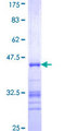 CD20 Protein - 12.5% SDS-PAGE Stained with Coomassie Blue.