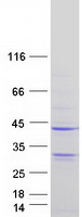 CD20 Protein - Purified recombinant protein MS4A1 was analyzed by SDS-PAGE gel and Coomassie Blue Staining