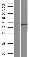 CD200 Protein - Western validation with an anti-DDK antibody * L: Control HEK293 lysate R: Over-expression lysate