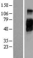 CD200R1 / CD200R Protein - Western validation with an anti-DDK antibody * L: Control HEK293 lysate R: Over-expression lysate