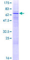CD200R1 / CD200R Protein - 12.5% SDS-PAGE of human CD200R1 stained with Coomassie Blue