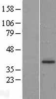 CD207 / Langerin Protein - Western validation with an anti-DDK antibody * L: Control HEK293 lysate R: Over-expression lysate