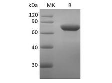 CD209 / DC-SIGN Protein - Recombinant Human DC-SIGN/CD209 (N-Fc)
