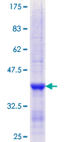 CD209 / DC-SIGN Protein - 12.5% SDS-PAGE Stained with Coomassie Blue.