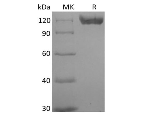 CD22 Protein - Recombinant Human B-cell Receptor CD22/Siglec-2/CD22 (C-6His) Biotinylated