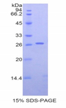 CD22 Protein - Recombinant Sialic Acid Binding Ig Like Lectin 2 By SDS-PAGE