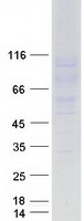 CD22 Protein - Purified recombinant protein CD22 was analyzed by SDS-PAGE gel and Coomassie Blue Staining