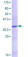 CD225 / IFITM1 Protein - 12.5% SDS-PAGE of human IFITM1 stained with Coomassie Blue