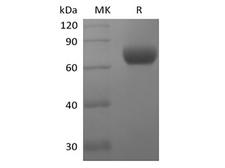 CD244 Protein - Recombinant Human Natural Killer Cell Receptor 2B4/SLAMF4/CD244 (C-Fc)