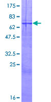 CD244 Protein - 12.5% SDS-PAGE of human CD244 stained with Coomassie Blue