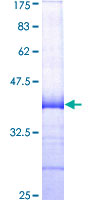 CD244 Protein - 12.5% SDS-PAGE Stained with Coomassie Blue.