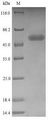 CD244 Protein - (Tris-Glycine gel) Discontinuous SDS-PAGE (reduced) with 5% enrichment gel and 15% separation gel.