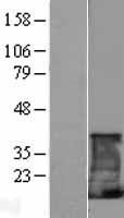 CD247 / CD3 Zeta Protein - Western validation with an anti-DDK antibody * L: Control HEK293 lysate R: Over-expression lysate