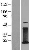 CD247 / CD3 Zeta Protein - Western validation with an anti-DDK antibody * L: Control HEK293 lysate R: Over-expression lysate