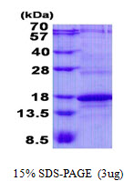 CD247 / CD3 Zeta Protein