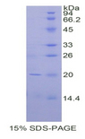 CD247 / CD3 Zeta Protein - Recombinant Cluster Of Differentiation 247 (CD247) by SDS-PAGE