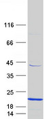 CD247 / CD3 Zeta Protein - Purified recombinant protein CD247 was analyzed by SDS-PAGE gel and Coomassie Blue Staining
