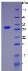 CD274 / B7-H1 / PD-L1 Protein - Recombinant Programmed Cell Death Protein 1 Ligand 1 By SDS-PAGE