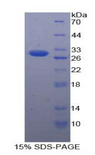 CD275 / B7-H2 / ICOS Ligand Protein - Recombinant Inducible T-Cell Co Stimulator Ligand By SDS-PAGE