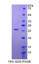 CD276 / B7-H3 Protein - Recombinant Cluster Of Differentiation 276 By SDS-PAGE