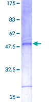 CD27L / CD70 Protein - 12.5% SDS-PAGE of human CD70 stained with Coomassie Blue