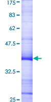 CD27L / CD70 Protein - 12.5% SDS-PAGE Stained with Coomassie Blue.