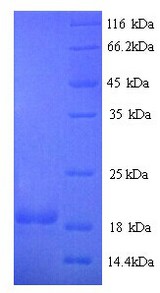 CD27L / CD70 Protein