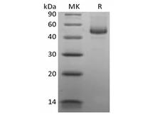 CD27L / CD70 Protein - Recombinant Human CD27 Ligand/TNFSF7/CD70 (C-mFc)
