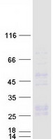 CD27L / CD70 Protein - Purified recombinant protein CD70 was analyzed by SDS-PAGE gel and Coomassie Blue Staining