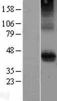 CD28 Protein - Western validation with an anti-DDK antibody * L: Control HEK293 lysate R: Over-expression lysate