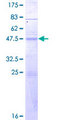 CD28 Protein - 12.5% SDS-PAGE of human CD28 stained with Coomassie Blue