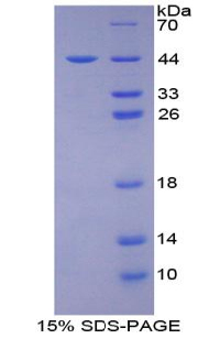 CD2AP Protein - Recombinant CD2 Associated Protein By SDS-PAGE