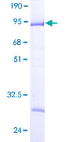 CD2BP2 Protein - 12.5% SDS-PAGE of human CD2BP2 stained with Coomassie Blue