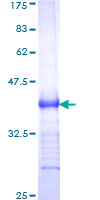 CD30 Protein - 12.5% SDS-PAGE Stained with Coomassie Blue.