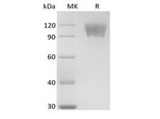 CD30 Protein - Recombinant Human TNFRSF8/CD30L Receptor/CD30 (C-mFc)