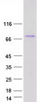 CD30 Protein - Purified recombinant protein TNFRSF8 was analyzed by SDS-PAGE gel and Coomassie Blue Staining